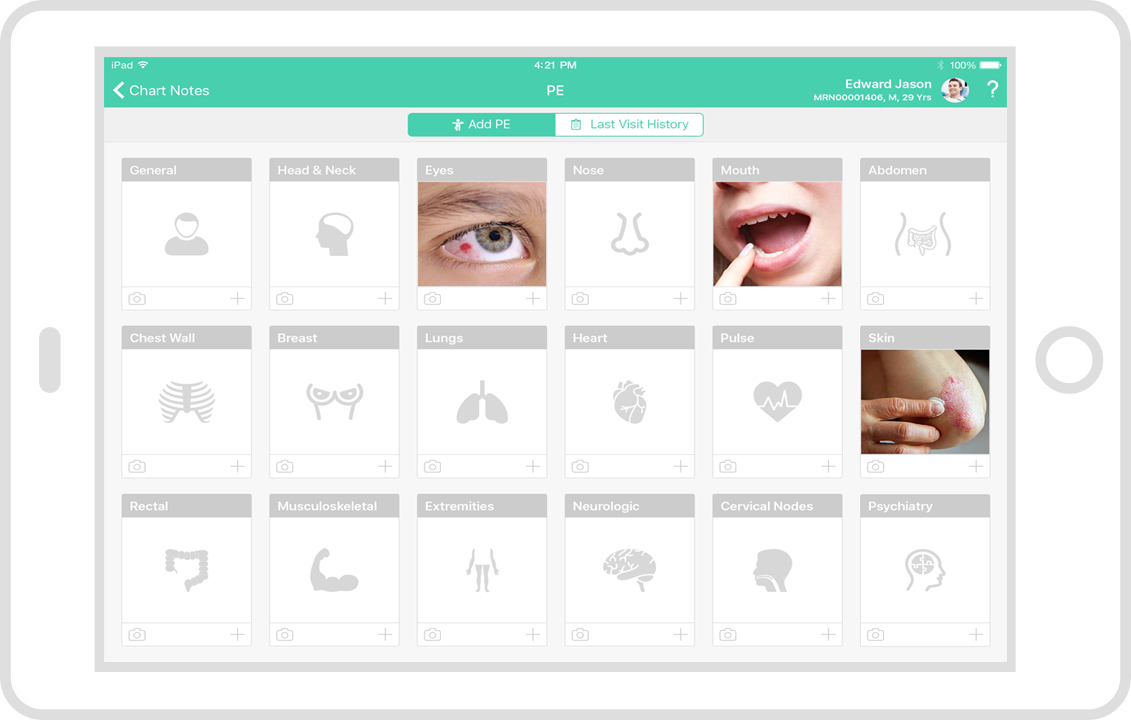 PHYSICAL EXAMINATION